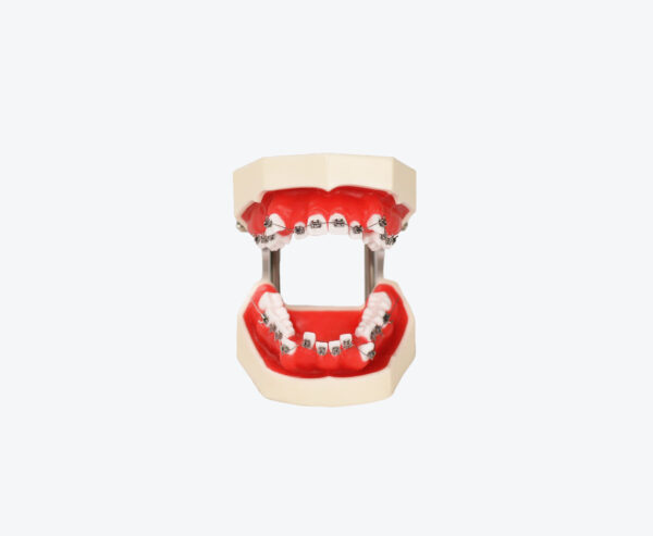 Orthodontic Training model with metal brackets