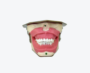 Anesthesia for tooth extraction