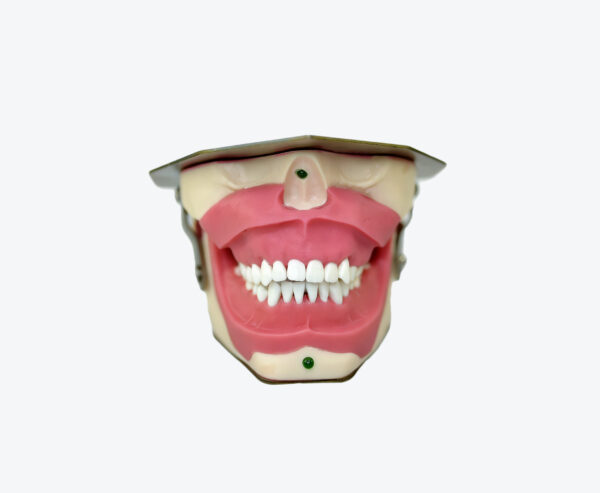 Anesthesia for tooth extraction