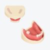 Dental Implant Training Model-Missing Tooth