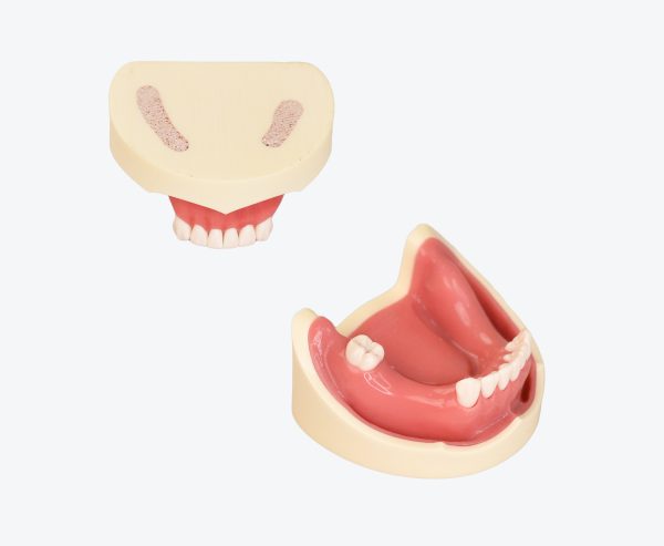 Dental Implant Training Model-Missing Tooth