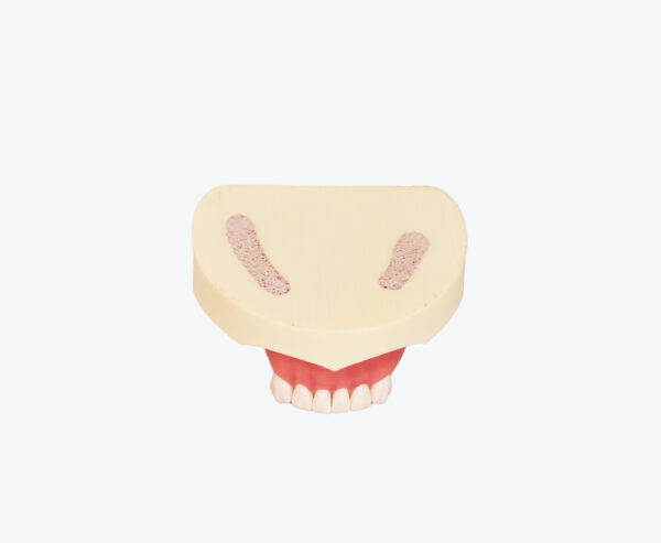 Dental Implant Training Model-Missing Tooth