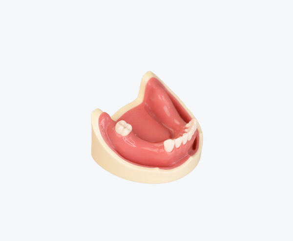 Dental Implant Training Model-Missing Tooth