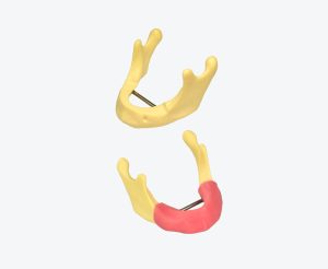 Mandibular bone model