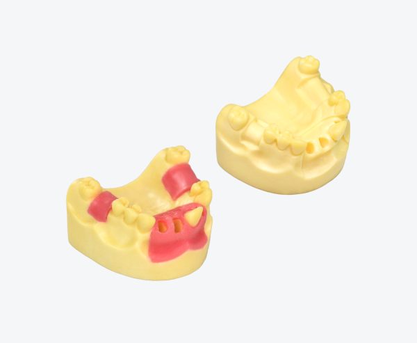 A denture-supported prosthetic with tooth models