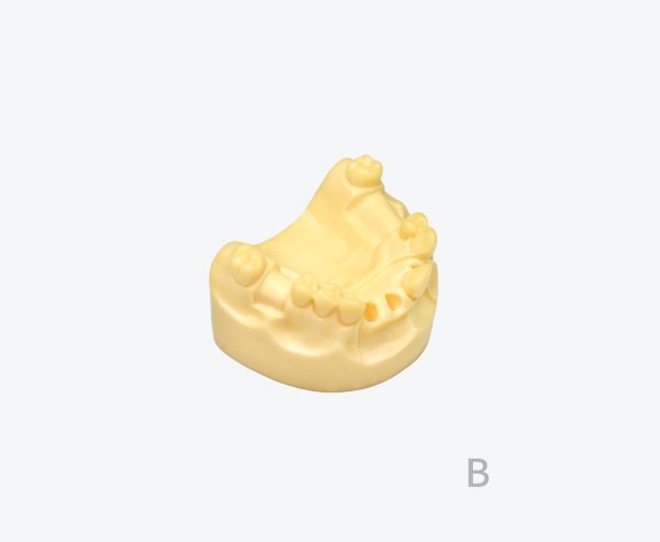 A denture-supported prosthetic with tooth models