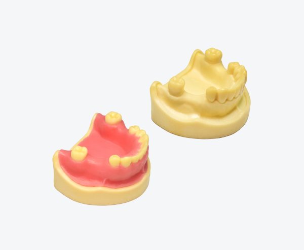 Mandibular absence of implant practice model