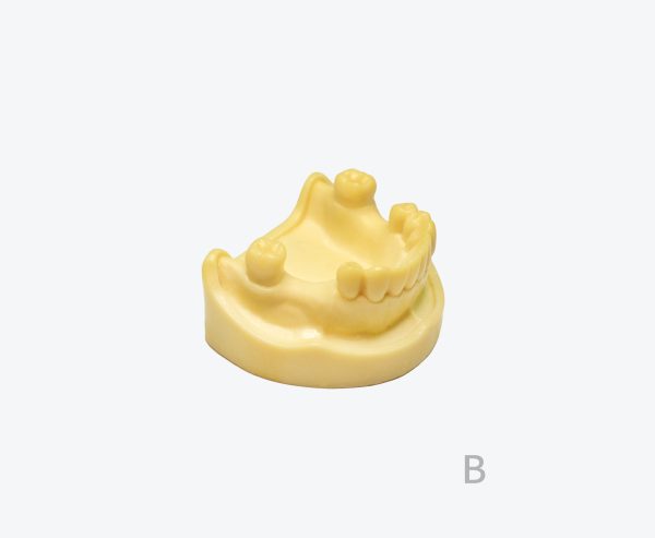 Mandibular absence of implant practice model