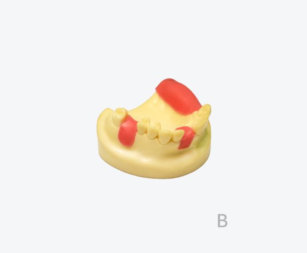 产品图片 14B Upper jaw implant training model