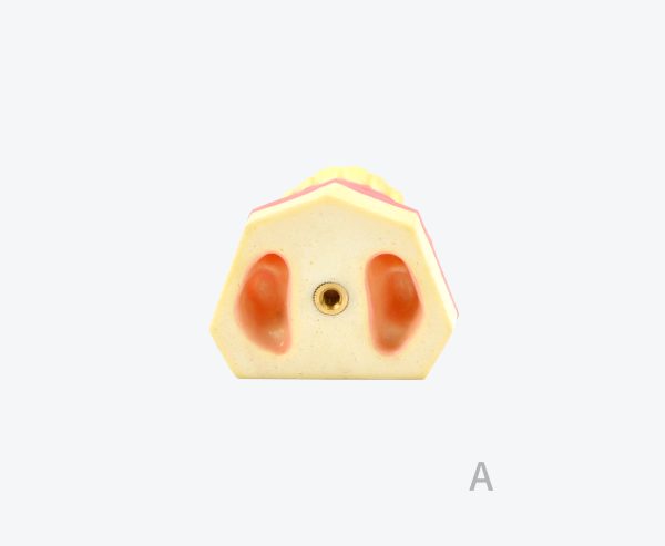 产品图片 15A- Upper jaw sinus implant training dental model
