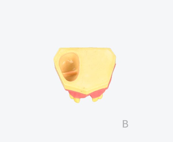 产品图片 15B- Upper jaw sinus implant training dental model