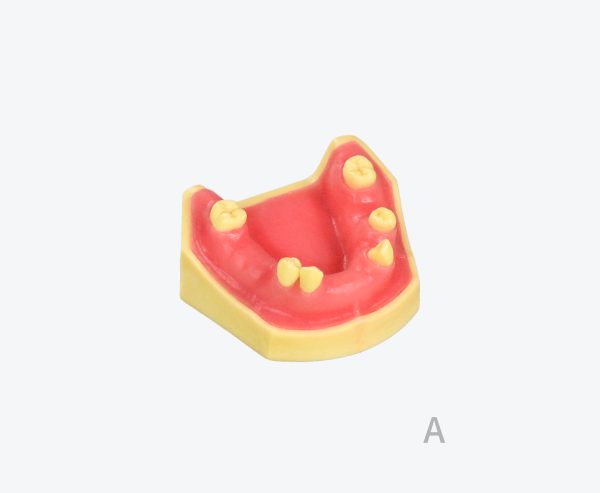 Lower jaw implant practice model
