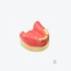 Lower jaw implant practice model