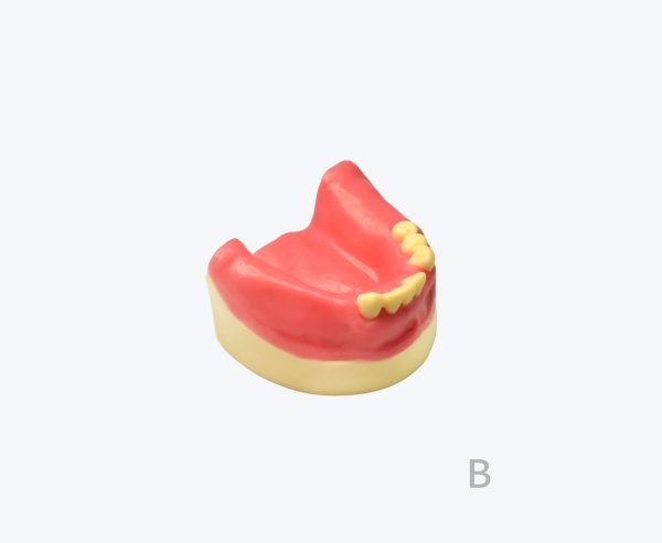Lower jaw implant practice model