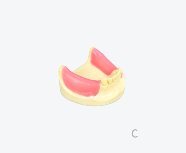 Lower jaw implant practice model