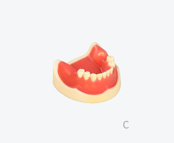 产品图片 17C Lower jaw implant training model