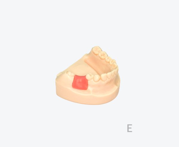 产品图片 17D Lower jaw implant training model