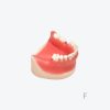 产品图片 17E Lower jaw implant training model
