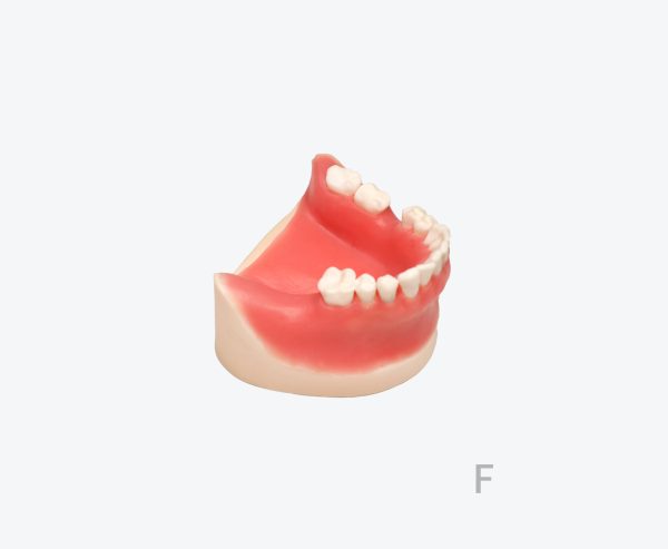 产品图片 17E Lower jaw implant training model