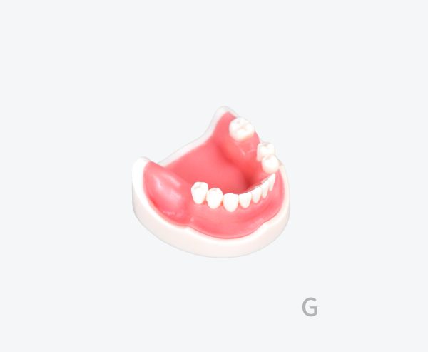 产品图片 17F Lower jaw implant training model