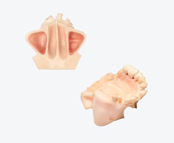 Maxillary sinus implantation without gum - biomimetic model