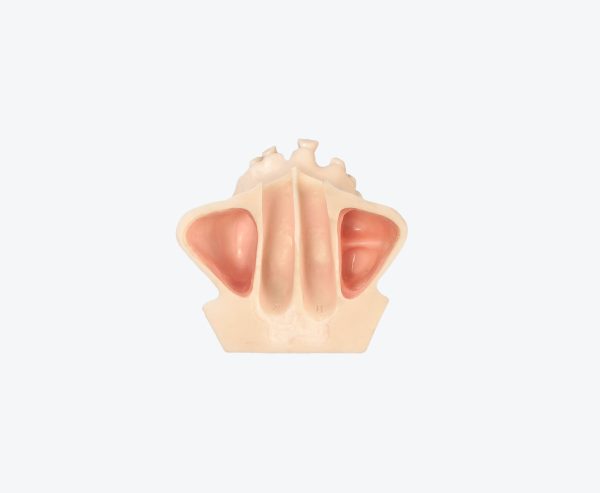 Maxillary sinus implantation without gum - biomimetic model