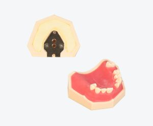 Upper jaw implant training model