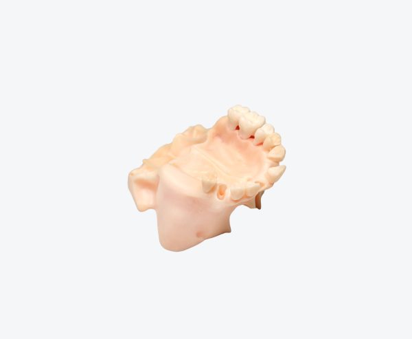 Maxillary sinus implantation without gum - biomimetic model