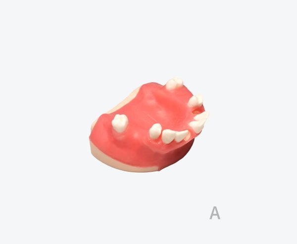 产品图片 18A- Upper jaw implant training model