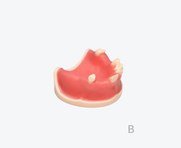 产品图片 18B Upper jaw implant training model