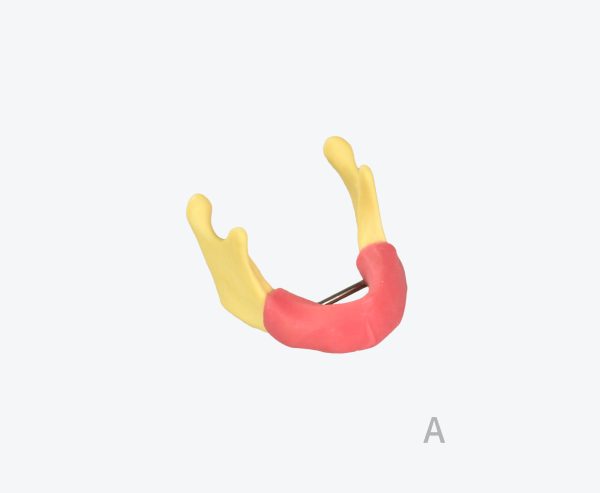 Mandibular bone model
