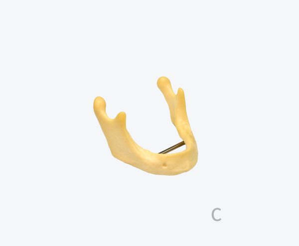Mandibular bone model