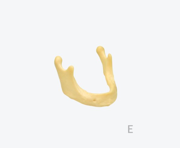 Mandibular bone model