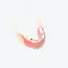 implant restoration denture shell demonstration models implant restoration denture shell demonstration models