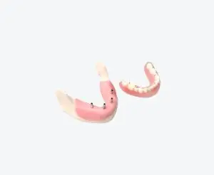 dental implant models dental implant models