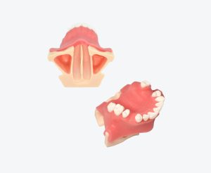 产品图片 4 Maxillary sinus implant model
