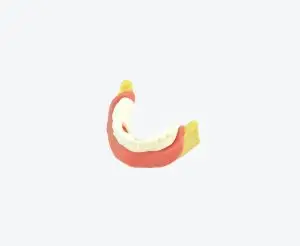 Buccal bone toothless model Buccal bone toothless model