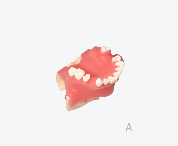 Maxillary sinus implant model