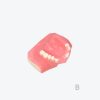 Maxillary sinus implant model