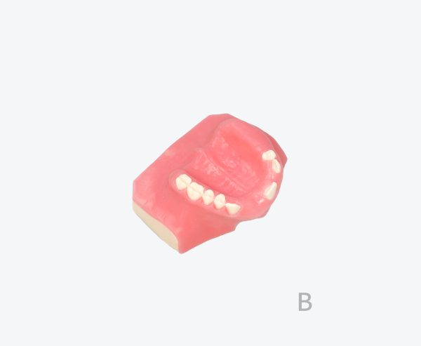 Maxillary sinus implant model