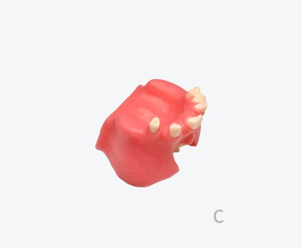 Maxillary sinus implant model