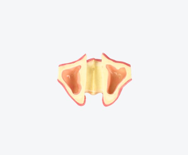 Lower jaw edentulous jaw implant training dental model