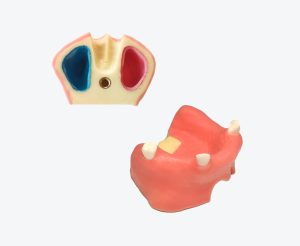 Maxillary sinus defect model