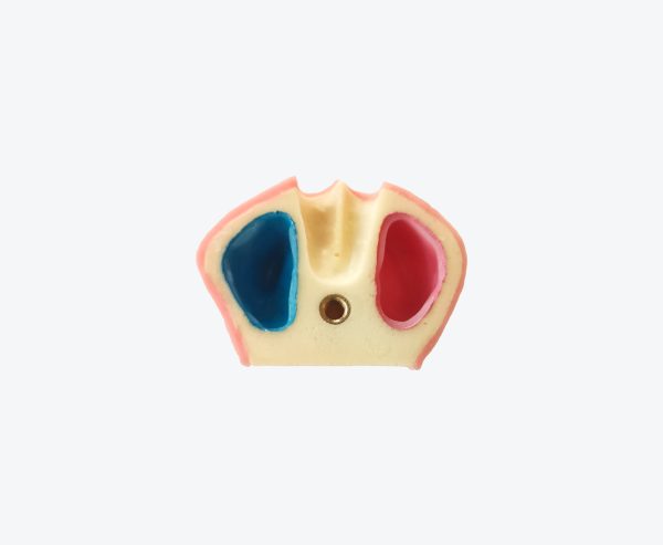 Maxillary sinus defect model Maxillary sinus defect model