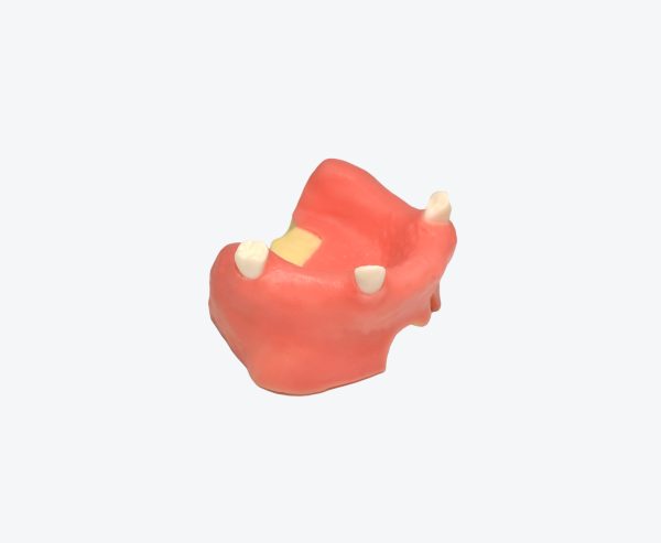Maxillary sinus defect model Maxillary sinus defect model
