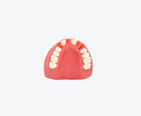 Maxillary extraction implant models