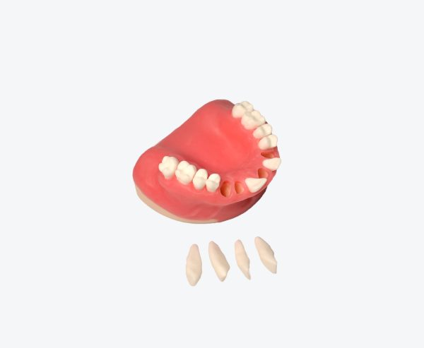 Maxillary extraction implant dental practice models