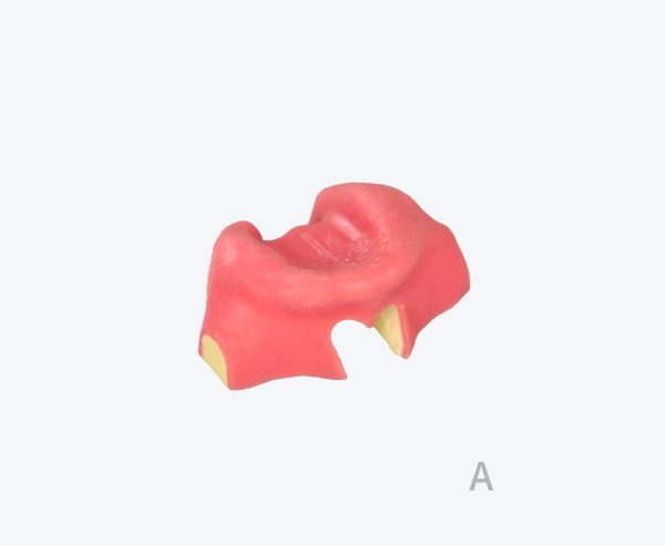 Lower jaw edentulous jaw implant training dental model