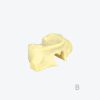 Lower jaw edentulous jaw implant training dental model