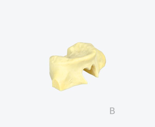 Lower jaw edentulous jaw implant training dental model